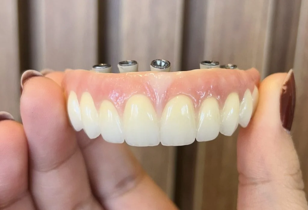 Protocolo em zircônia: material premium branco e biocompatível